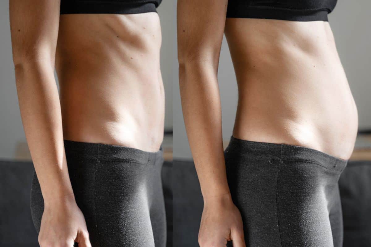 How long does diastasis recti take to improve Beccles?