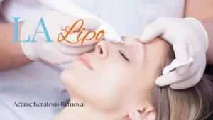 Woman receiving Actinic Keratosis Removal Treatment Beccles