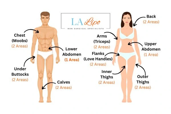LA LIPO Cryolipolysis Areas Beccles