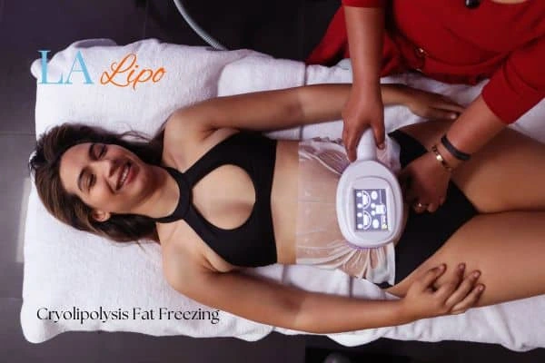 woman getting cryolipolysis Beccles