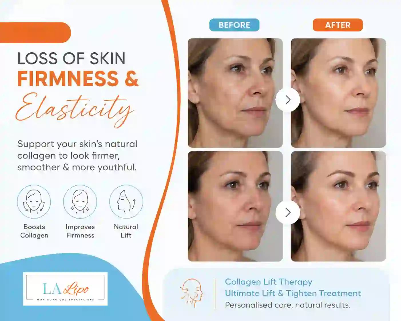Sign #7: Loss of Skin Firmness and Elasticity Beccles