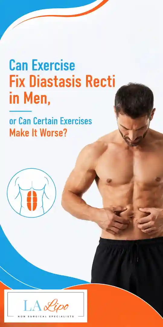 Can Exercise Fix Diastasis Recti in Men, or Can Certain Exercises Make It Worse Beccles?