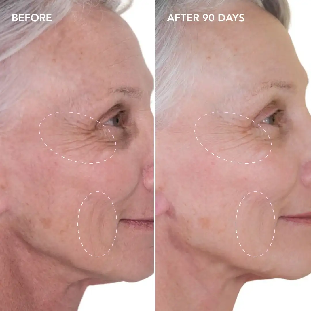 When will you see results Beccles